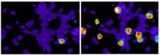 In a bundle of sensory nerve cells, only a small number are sensitive to TSLP (left). By comparison, a larger fraction responds to capsaicin (right), the component of chili peppers that produces the burning sensation. Credit: Diana Bautista, Ph.D., University of California, Berkeley.