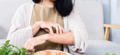 Woman scratching a red rash on her forearm while sitting near a plate of shrimp and fresh greens.