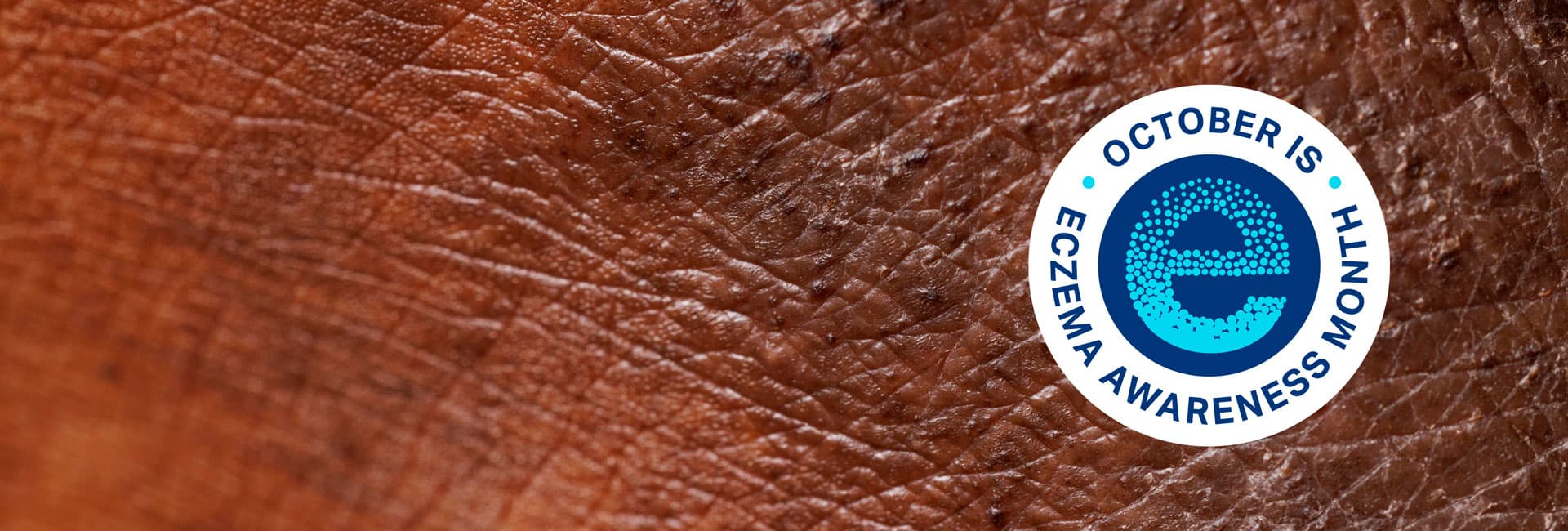 Eczema Awareness Month logo with skin background behind