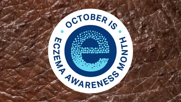 Eczema Awareness Month logo with skin background