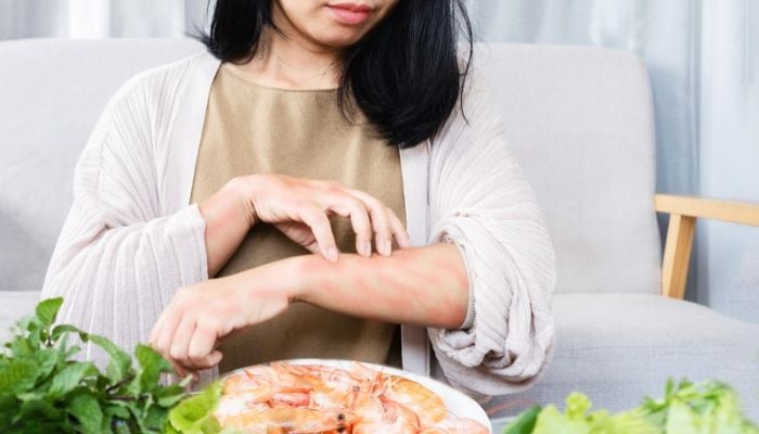 Woman scratching a red rash on her forearm while sitting near a plate of shrimp and fresh greens.