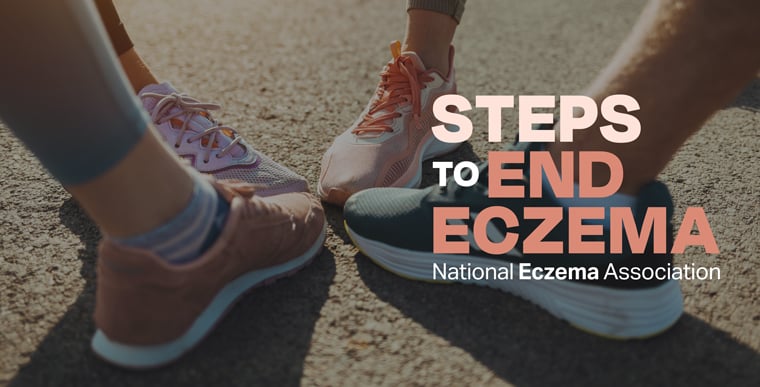Steps to End Eczema Hero image with group of people putting shoes together in circle in background