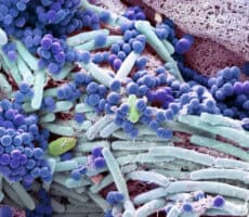 Microscopic view of bacteria and microorganisms on the skin surface in blue and purple tones, representing the skin microbiome and its connection to eczema.