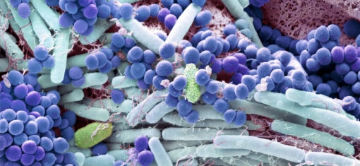 Microscopic view of bacteria and microorganisms on the skin surface in blue and purple tones, representing the skin microbiome and its connection to eczema.