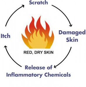 red_dry_skin_flame-295x300.jpg