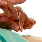 Acupunture and natural eczema treatments