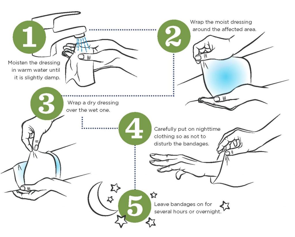 Instructions for using wet wrap therapy