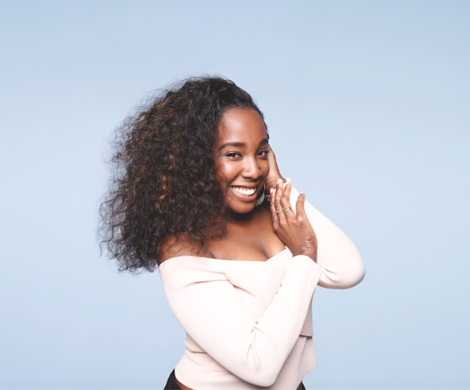 Models with eczema get ready for their close-up