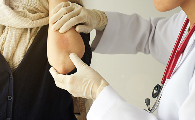 Understanding inflammation’s role in atopic dermatitis