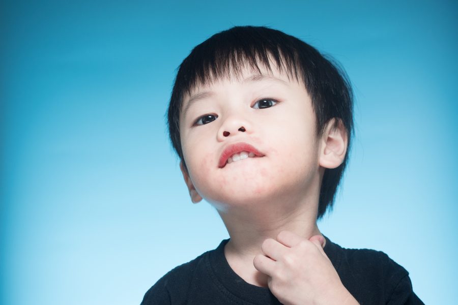 Are you itching for eczema-friendly products?