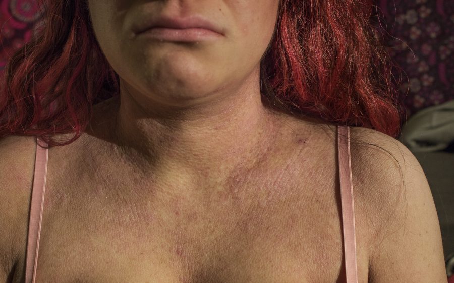 Picture Perfect: Learning to love the skin I’m in