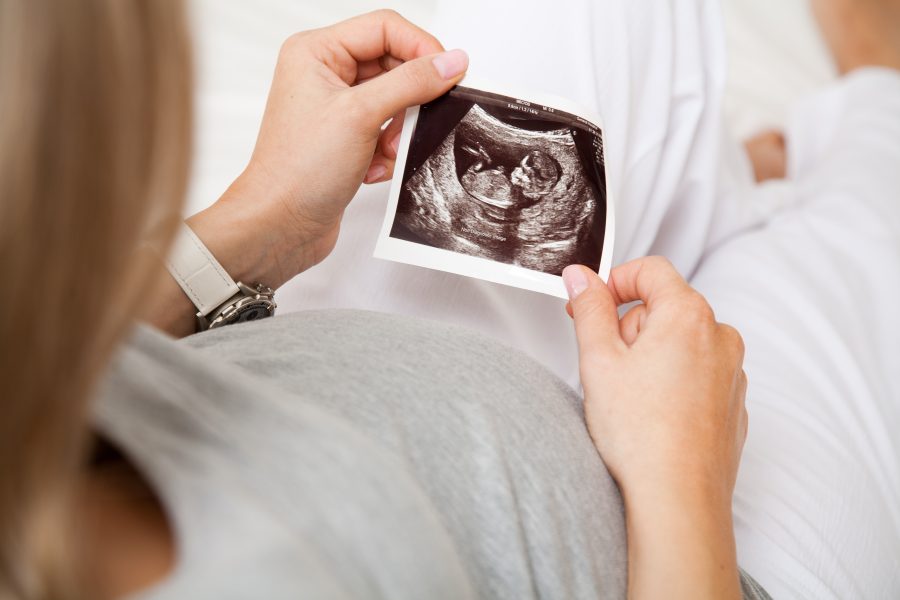 Should I go on dupilumab if I’m thinking about getting pregnant?