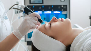 A woman receives laser treatment of the face in a cosmetology clinic, a concept of skin rejuvenation is being developed. laser peeling