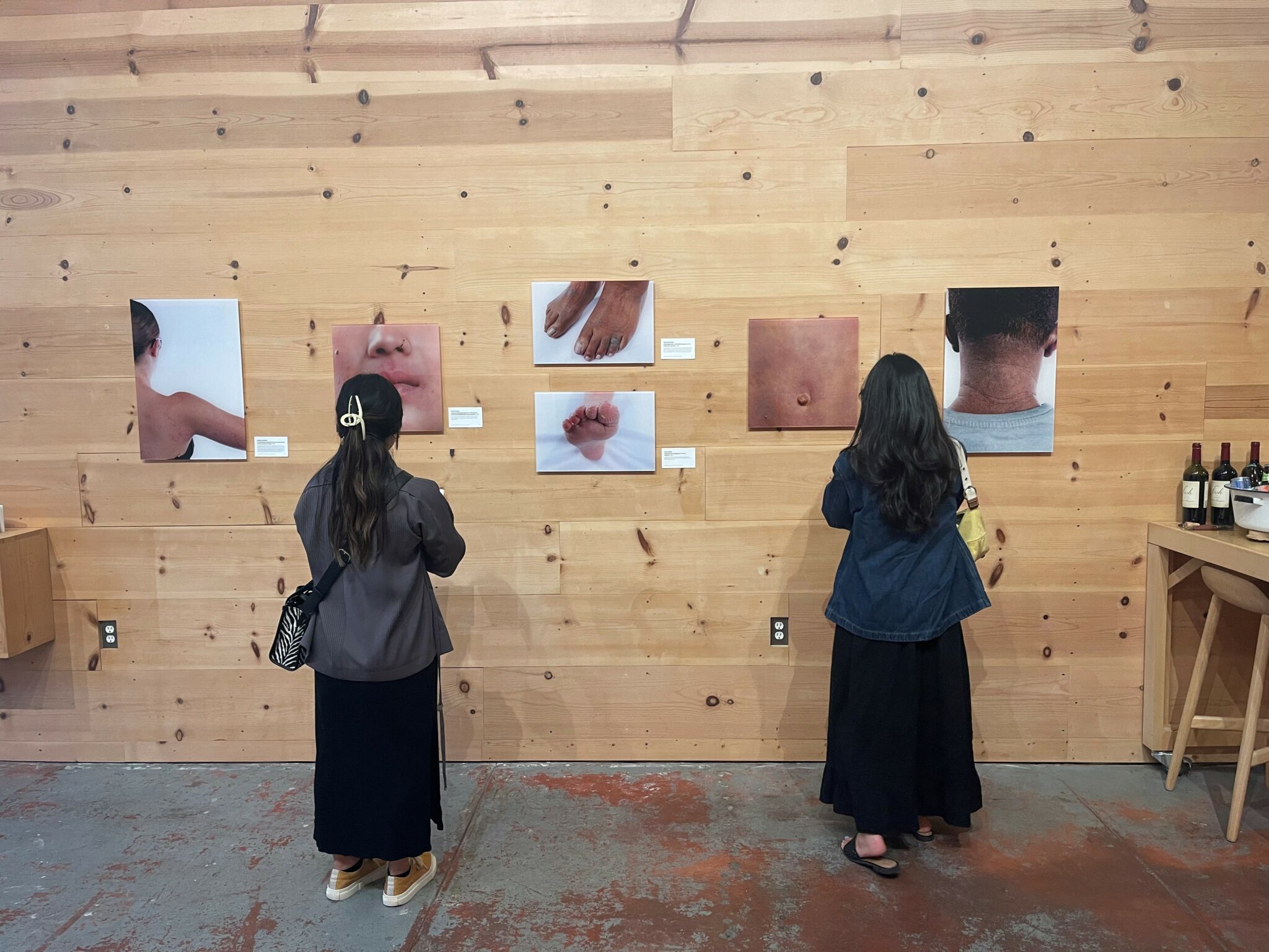 Eczema Awareness Month 2024 The Eczhibition National Eczema Association